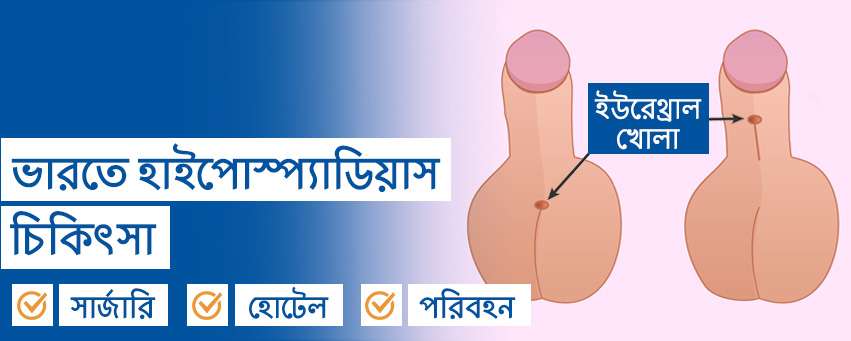 হাইপোস্প্যাডিয়াস (Hypospadias) সার্জারি